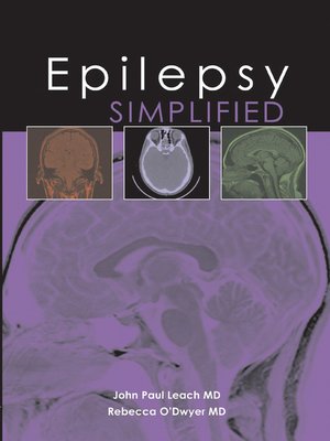 cover image of Epilepsy Simplified